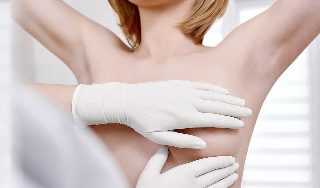 Síntomas del cáncer de mama